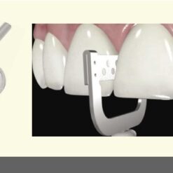 Alternative view of Orthodontic Strip H-t SRTV40H , Osung