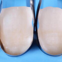 Alternative view of Unica anterior Introkit, polydentia